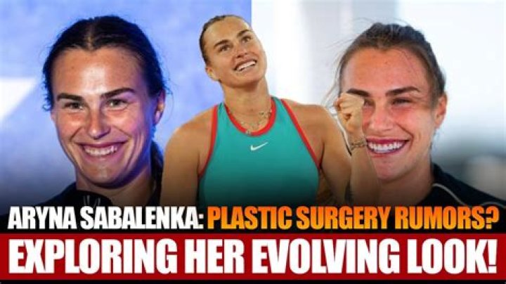 Aryna Sabalenka | Done Plastic Surgery? Before And After