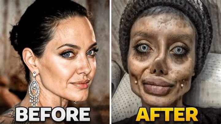Atty Sam Ferrer Before &amp; After Surgery Pictures – Details We Have On The Web Star