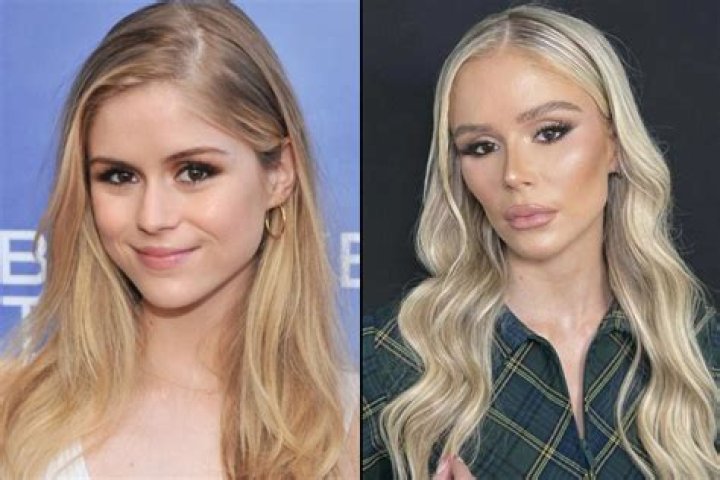 Did Big Brother Contestant Angela Rummans Ever Undergo Plastic Surgery? Before And After Pictures