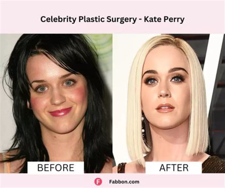 Did Riley Keough Get Her Nose Done? Surgery Before And After Photos