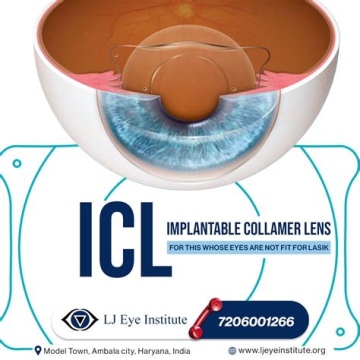 Elizabeth Tulloch Eyes Following ICL Surgery On Grimm