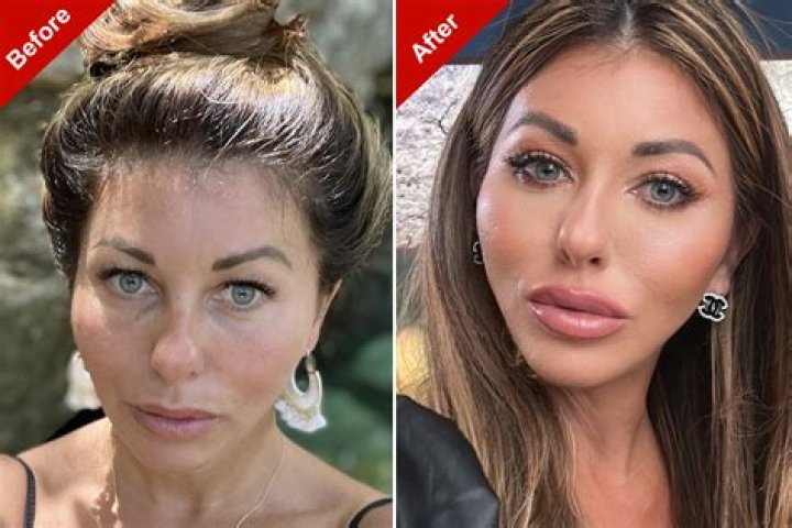 Is Boho Beautiful Juliana did Plastic Surgery? Her Age,Tattoo and more
