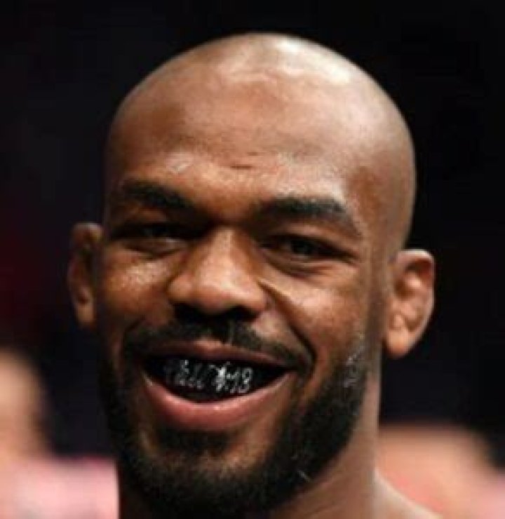 Jon Jones Teeth Before And After | What Does He Have On His Teeth