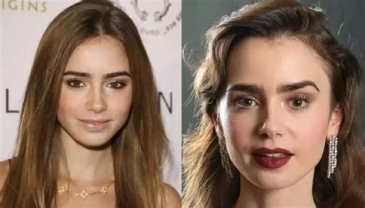 Lily Collins Plastic Surgery -Before And After Photos, Beauty Secret Explored!