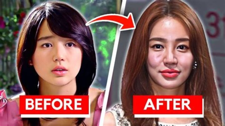 Lovi Poe Before Surgery | Filipino Actress Plastic Transformation