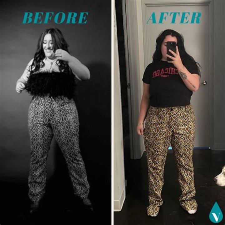 Natasia Demetriou Weight Gain Or Pregnant In 2022: Here Are Before And After Pictures