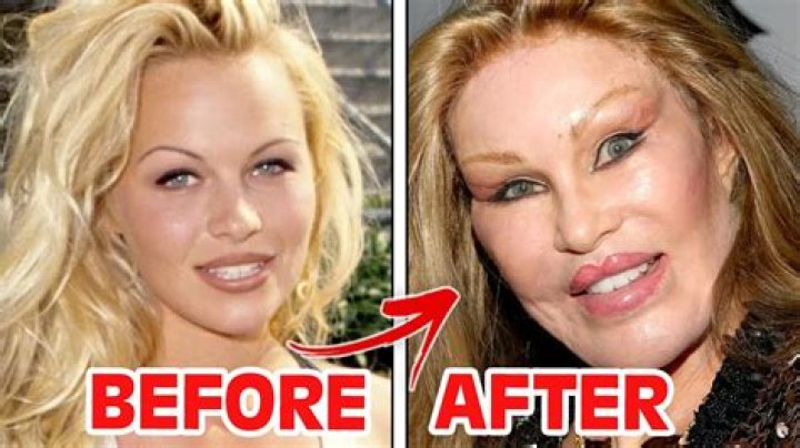 Nikki Haley Nose Job And Botox: Plastic Surgery Rumors