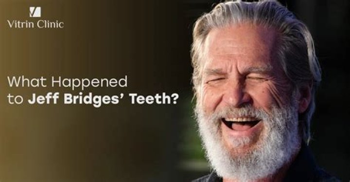 What Happened To Jeff Bridges’ Teeth? American Actor’s New Look Explored